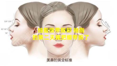抽脂绷带腿部 抽脂的第二天就把绷带拆了